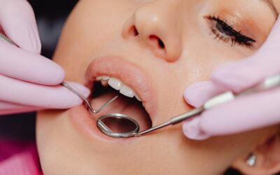 Why Teeth Cleaning Matters